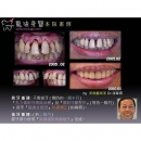 Periodontal Treatment - Periodontal Disease Treatment-1