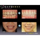 Orthognathic Surgery Recovery - Dental Orthodontic-8