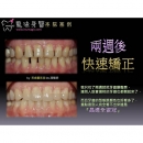 Dental Cosmetics - Dental Esthetics-7