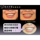 Dental Prosthetics - Dental Prosthodontics-1