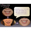 Cosmetic Dental Treatment - Dental Orthodontic-9