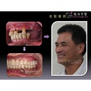 Tooth Surgery - Good Dentist-14
