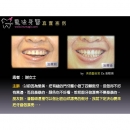 Dental Center - Dental Implants-2