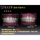 Teeth Whitening Treatments - Dental Esthetics-2
