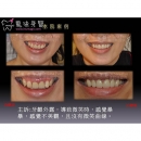 Dental Corrective Surgery - Dental Orthodontic-7