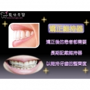 Dental Braces - Dental Orthodontic-13