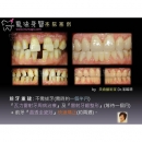 Cosmetic Dental Surgery - Dental Esthetics-6