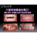 Children Dental Treatment - Children Dental-3
