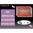 Dental Correction - Dental Orthodontic-6
