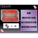 Dental Retainer - Dental Orthodontic-12