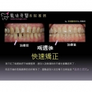 Teeth Whitening Treatment - Dental Esthetics-1